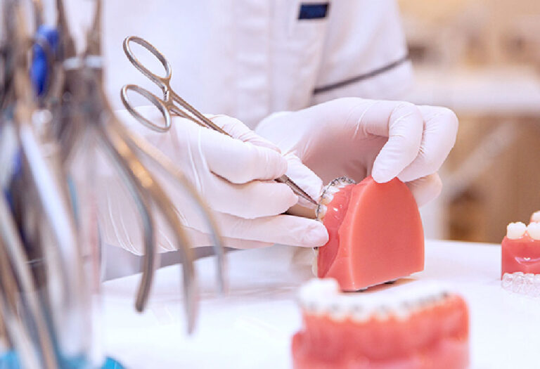 知らないと損する裏側矯正の7つの特徴と選び方